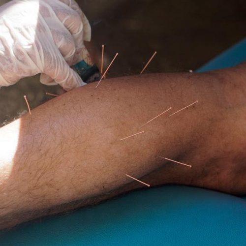 239445553_1688362538028524_4517564740830662653_n