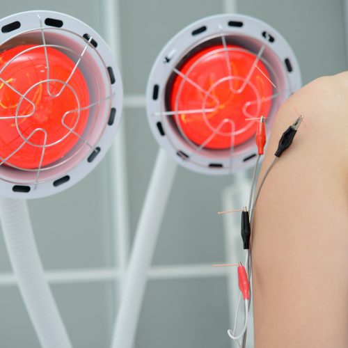 Electro Acupuncture.Traditional Chinese acupuncture and Electroacupuncture on body of patient